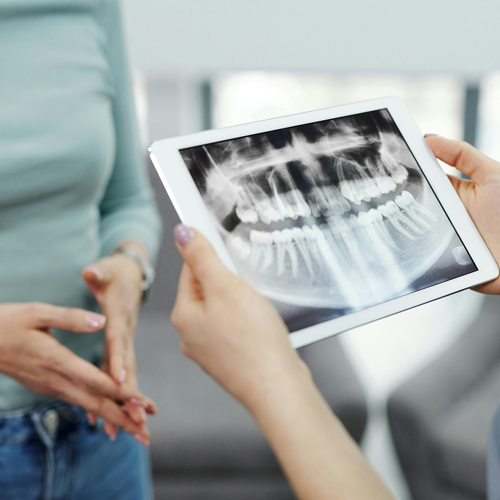 Dentist reviewing a dental x-ray on a tablet